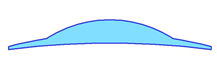 shape 11 Shape #11: Lenticular A high base curve “bowl” on a flatter carrier lens. Can be done free-form or using standard semi-finished lenses.