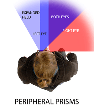 Peripheral Prism Field of View Animation