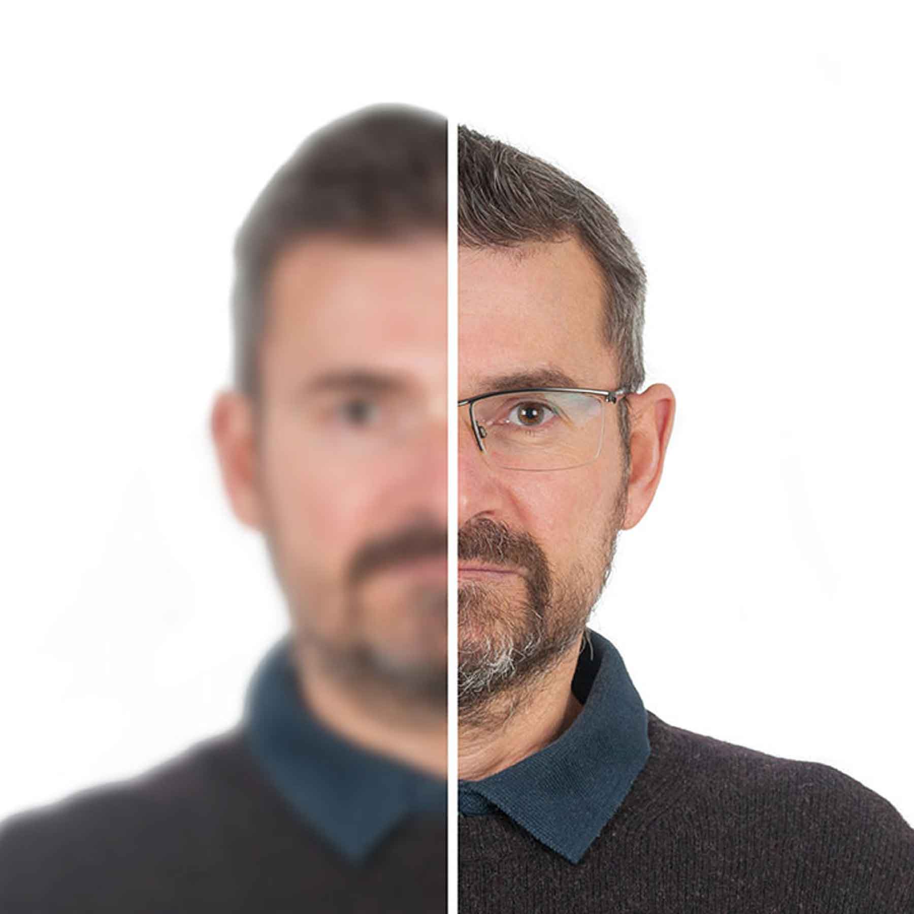 Man with one side of his face in sharp focus and the other side blurred, demonstrating vision impairment.